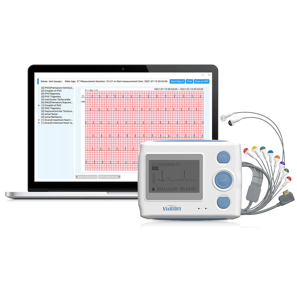 Wellue Portable Blood Pressure Monitor with EKG, Supporting AI