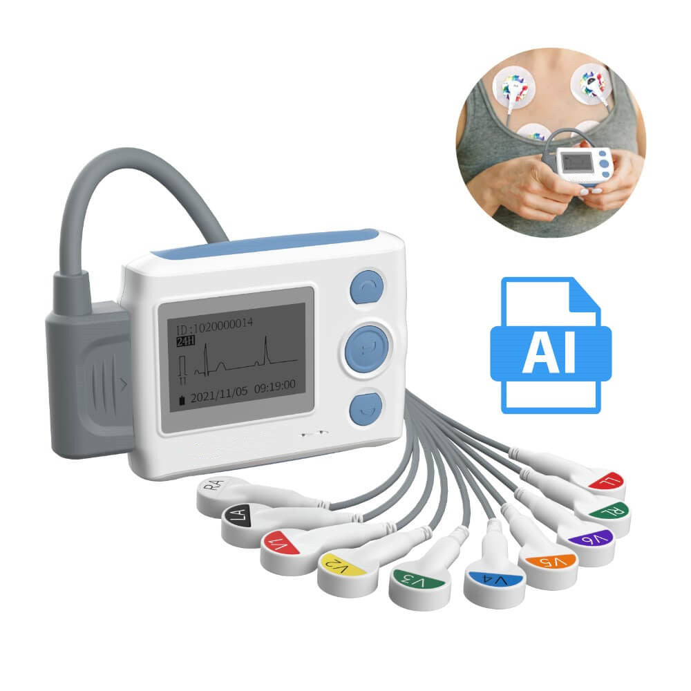 Wellue 12-Lead Holter Monitor with AI Analysis — 24-часовой холтеровский  мониторинг с отчетом AI