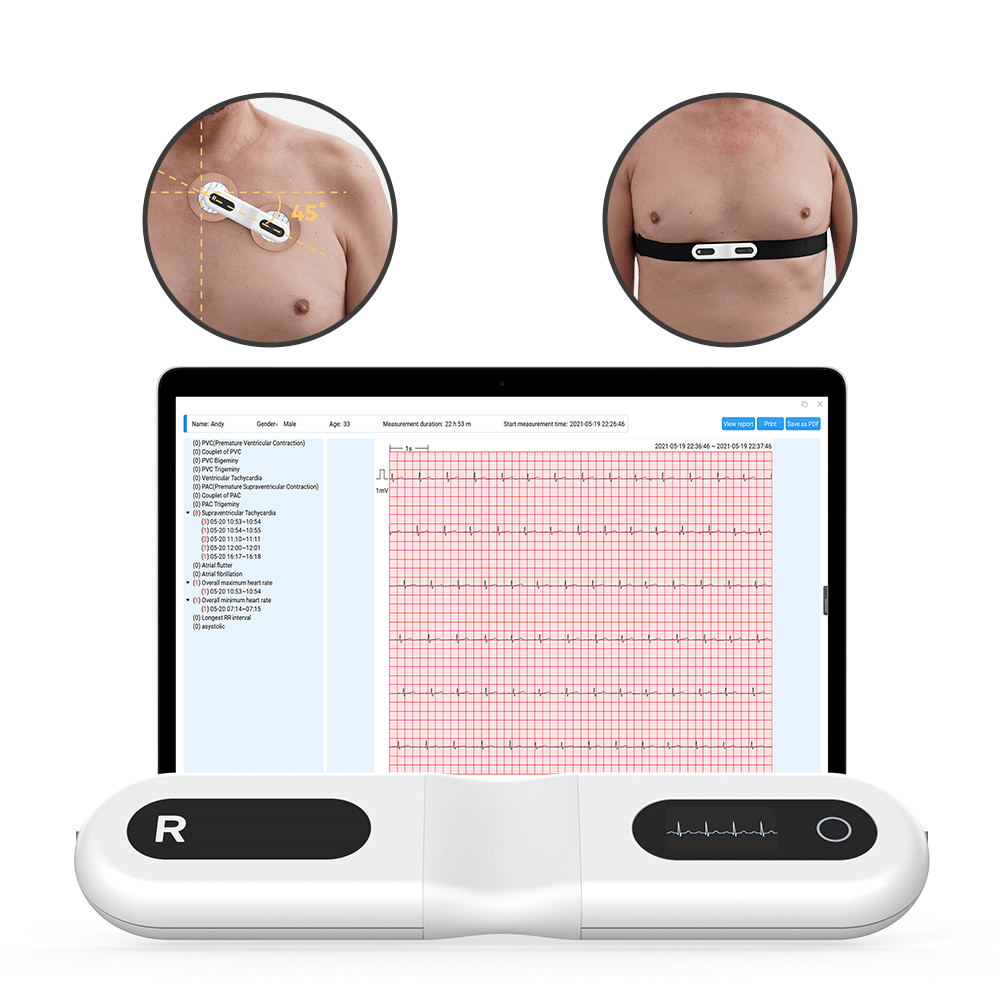 24/72-Hour ECG Monitor with Screen, Screen for Arrhythmias with AI Analysis  – Wellue