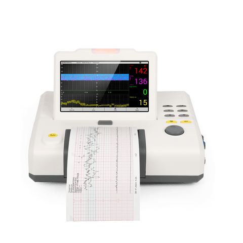 fetal monitor with built-in thermal printer