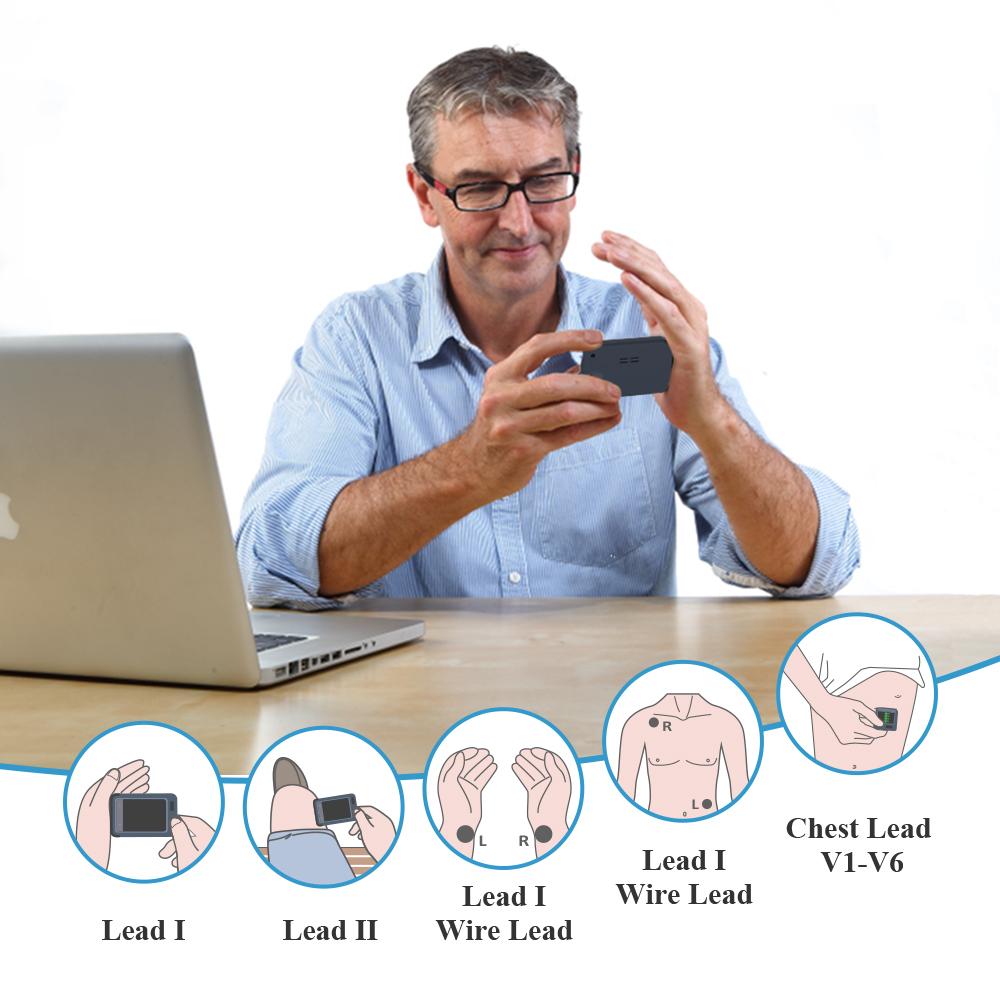 Personal ECG Monitor With AI Analysis. Get ECGs & Results On ...