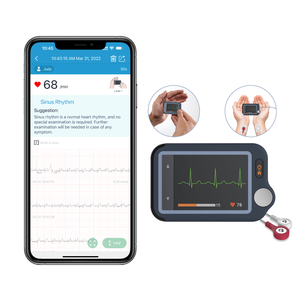 Monitor de ECG con pantalla táctil para realizar comprobaciones rápidas del ritmo cardiaco en casa
