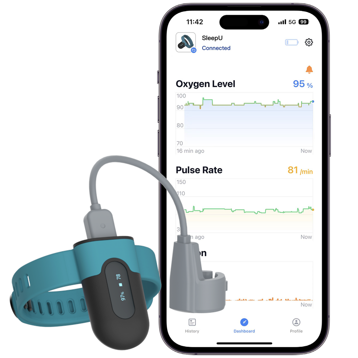 Wellue SleepU Continuous Wrist Oxygen Monitor. Free APP PC.Track O2 levels and heart rate while sleeping