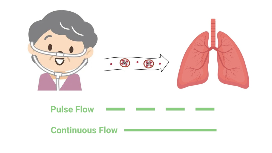 Pulse Dose Delivery vs. Continuous Flow