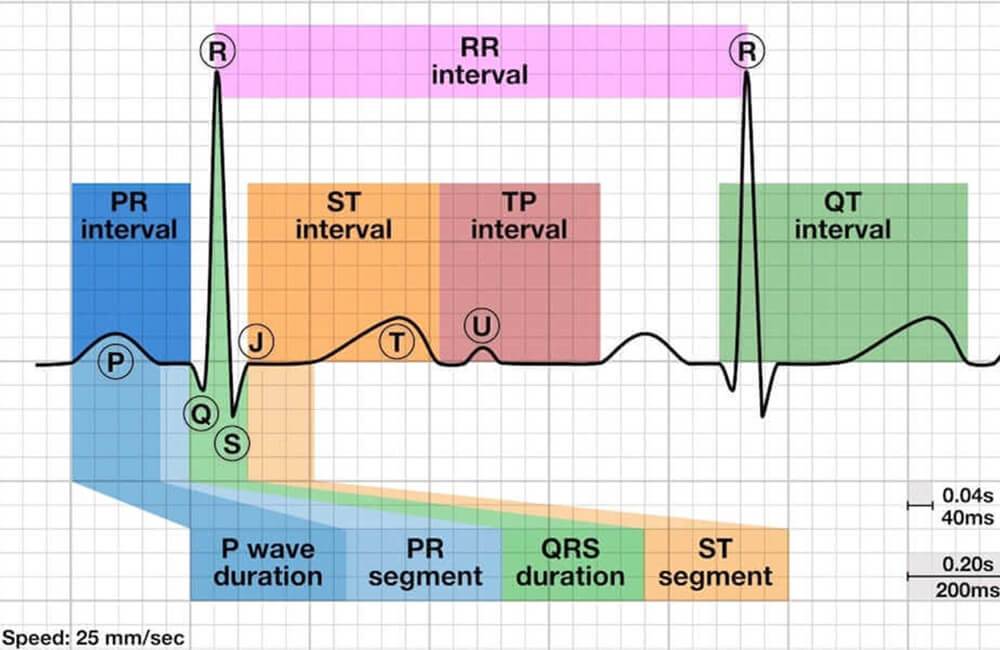 Que comprend le rapport AI ECG