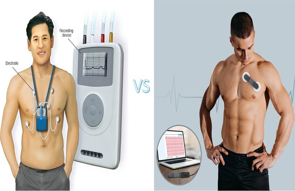 A Comparison of Holter Monitor and Wellue 24-Hour ECG Recorder with AI Analysis