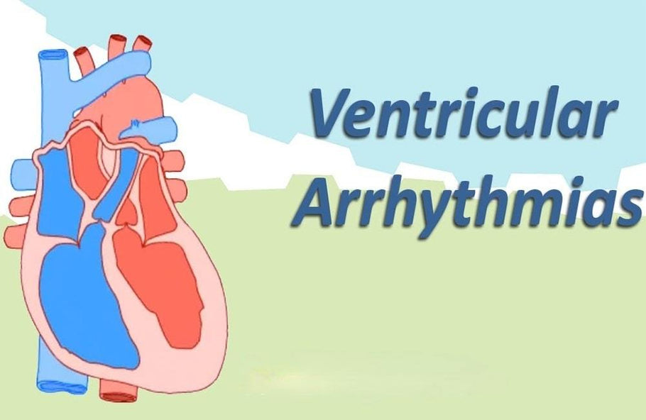 Is Ventricular Arrhythmia Serious?
