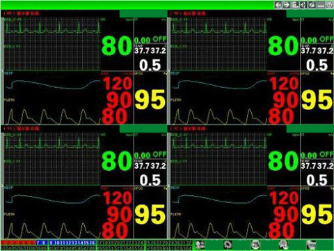 Central Station Software for 12-Inch Patient Monitors