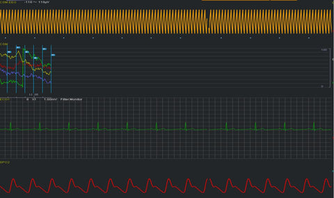 Central Monitoring Software