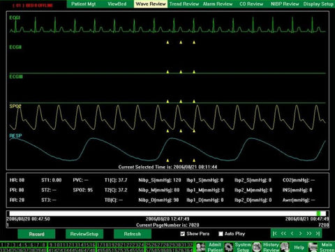 Central Station Software for 12-Inch Patient Monitors