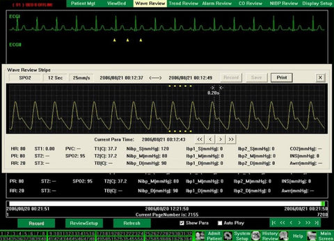 Central Station Software for 12-Inch Patient Monitors