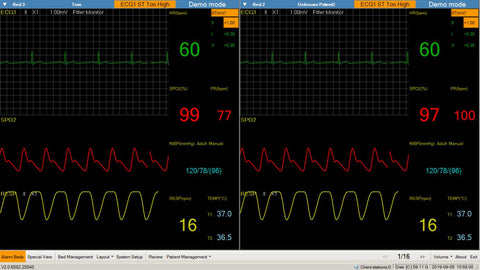 Central Monitoring Software