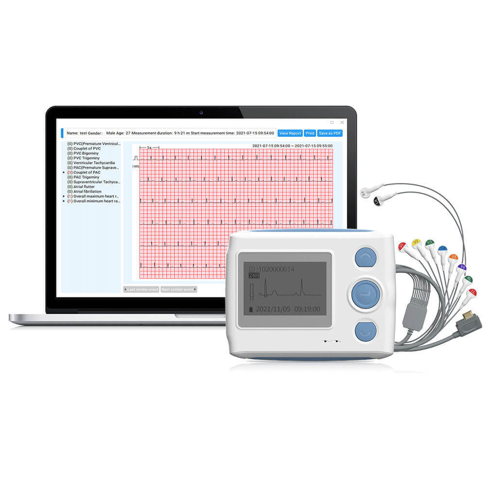 Mobile 6/12-Lead EKG/ECG Machine Fits into Your Pocket, with Auto ...