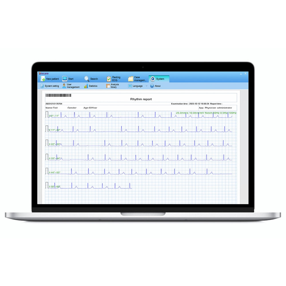نظام إدارة بيانات تخطيط القلب (ECG).