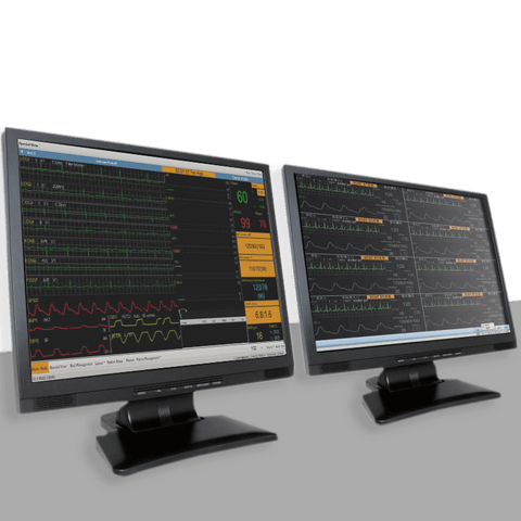 Software di monitoraggio centrale