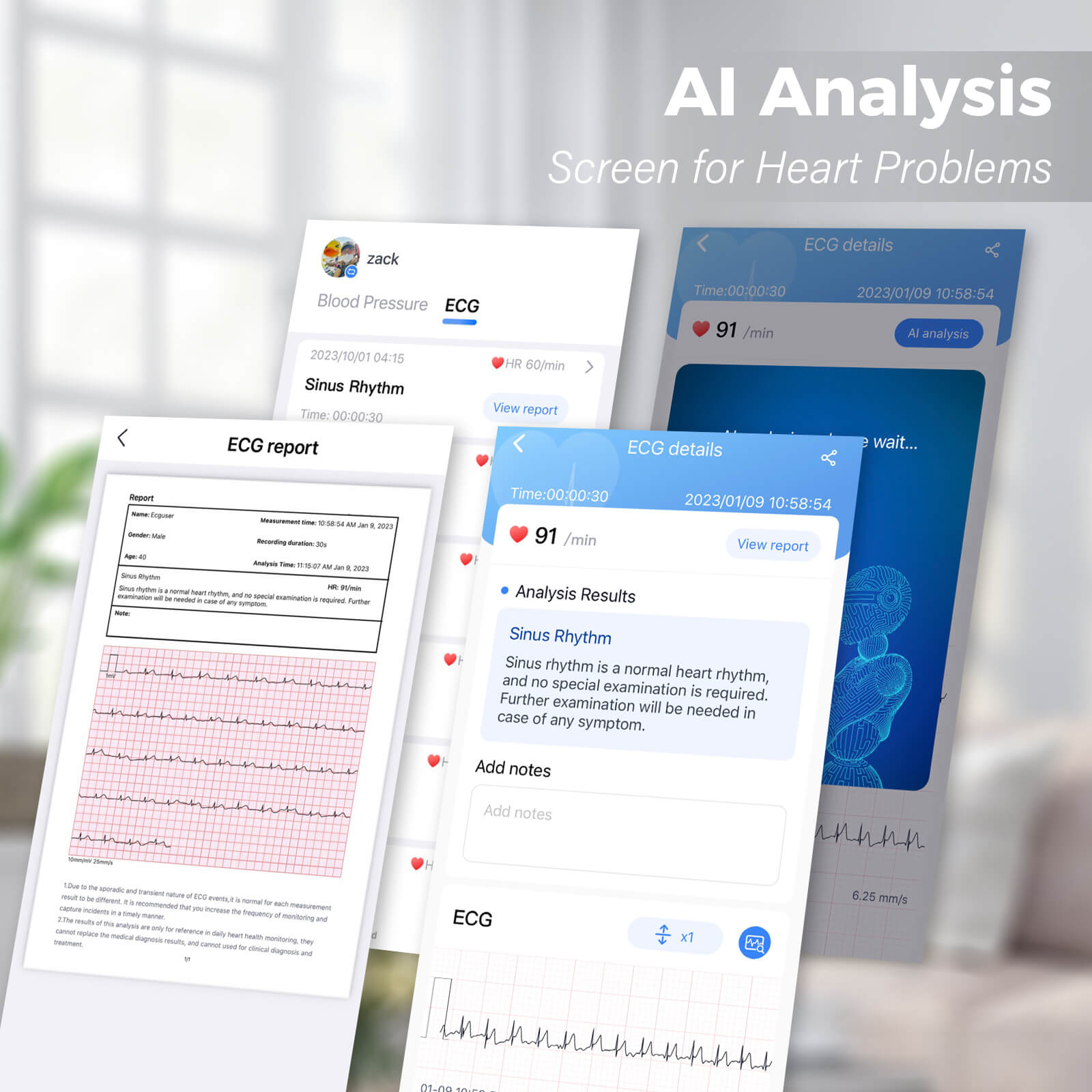 app dashboard and ecg report
