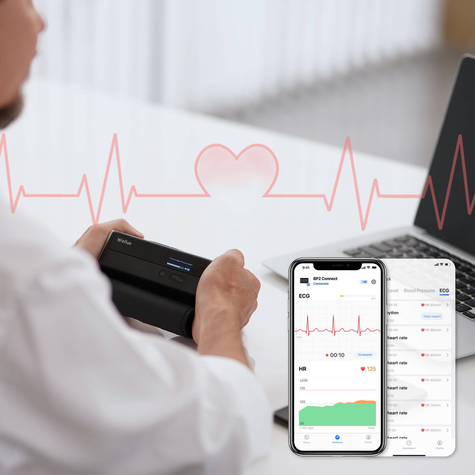 ecg tracking