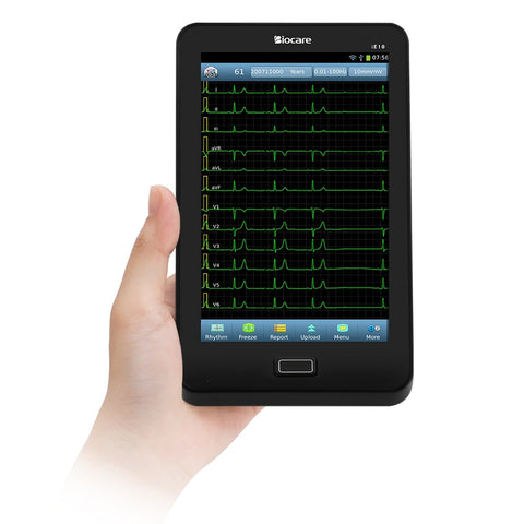 handy 12-channel resting EKG machine based on a tablet