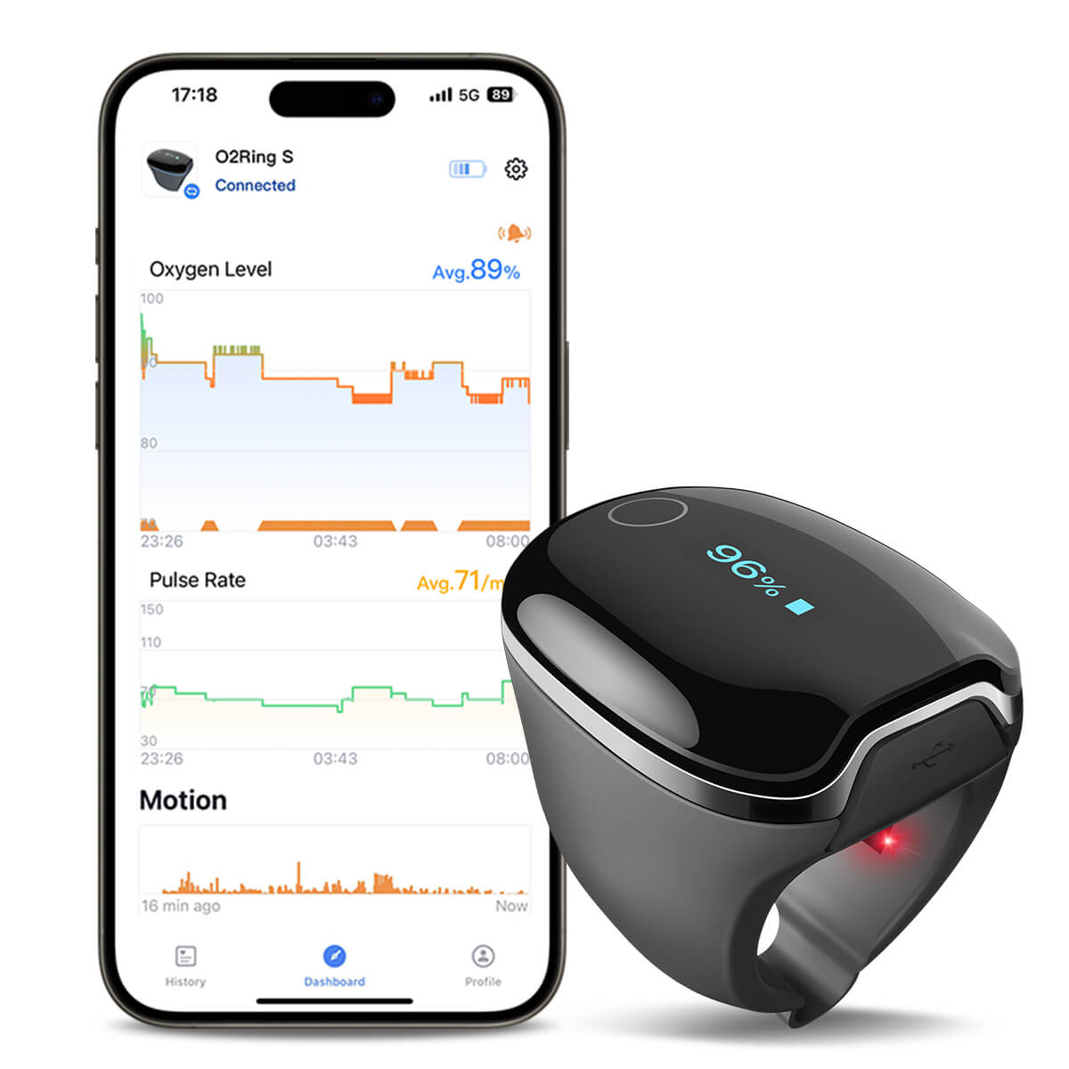 Wellue O2RingS | Upgraded Pulse Oximeter Ring with 24h Oxygen tracking ...