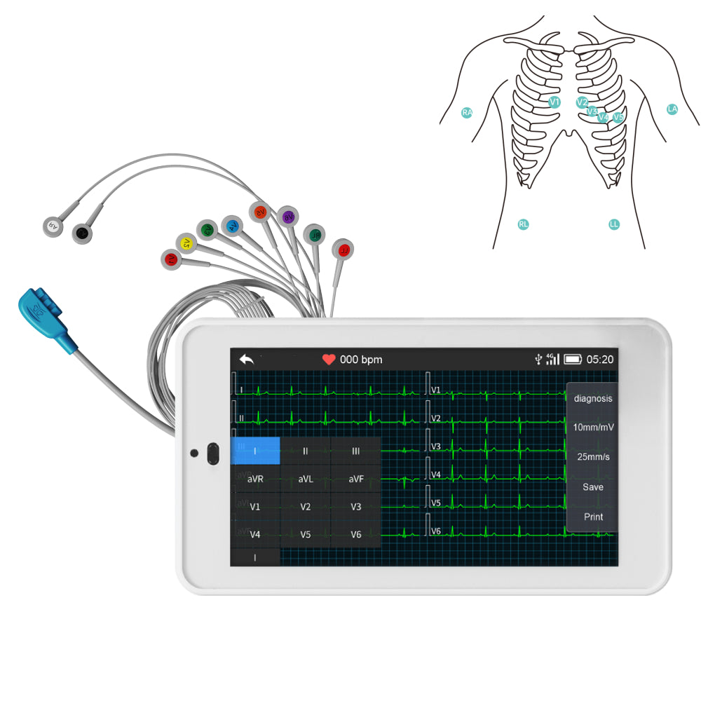 Pocket ECG Machine 6/12 lead Portable with Glasgow Resting ECG Analysis  system