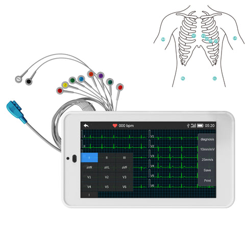 Portable 12-Lead ECG Machine with Interpretation Fits into Your Pocket ...