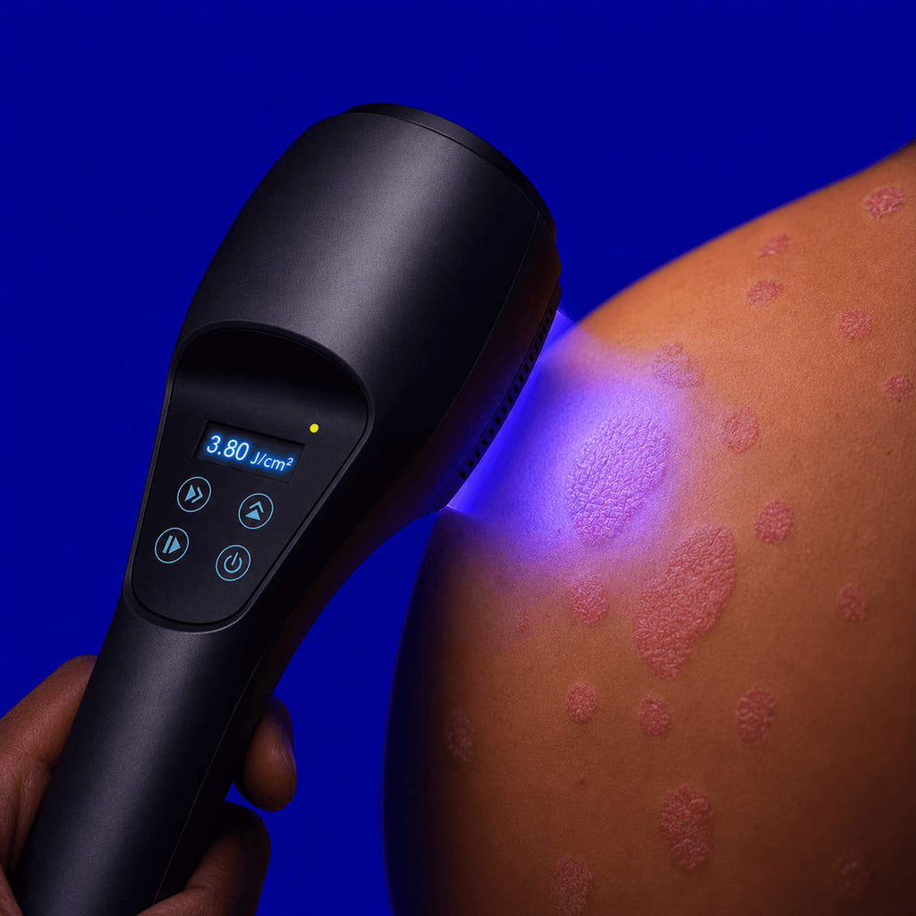 Close-up of the Wellue 308nm targeted UVB light creating a focused treatment area on the skin