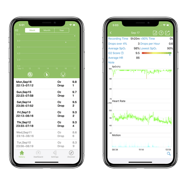 Vibeat KidsO2 Oximeter