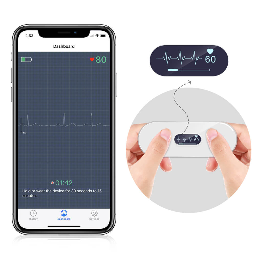 Wellue Portable Blood Pressure Monitor with EKG, Supporting AI  Interpretation via the Free App