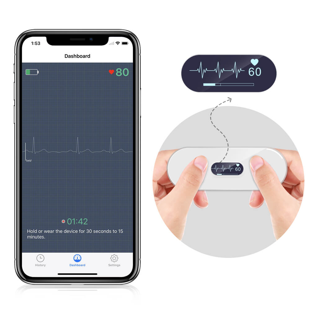 Portable ECG/EKG Monitor with OLED Screen Detect Arrhythmias with Your