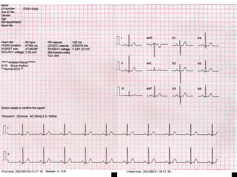 Biocare iE12A EKG-Papier (3 Packungen)