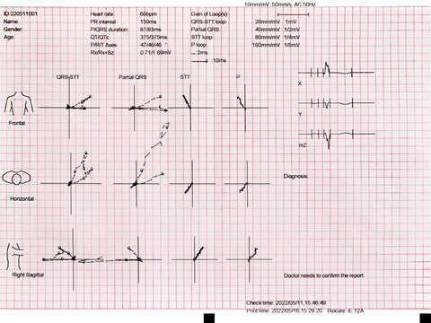 12-Kanal-EKG-Papier