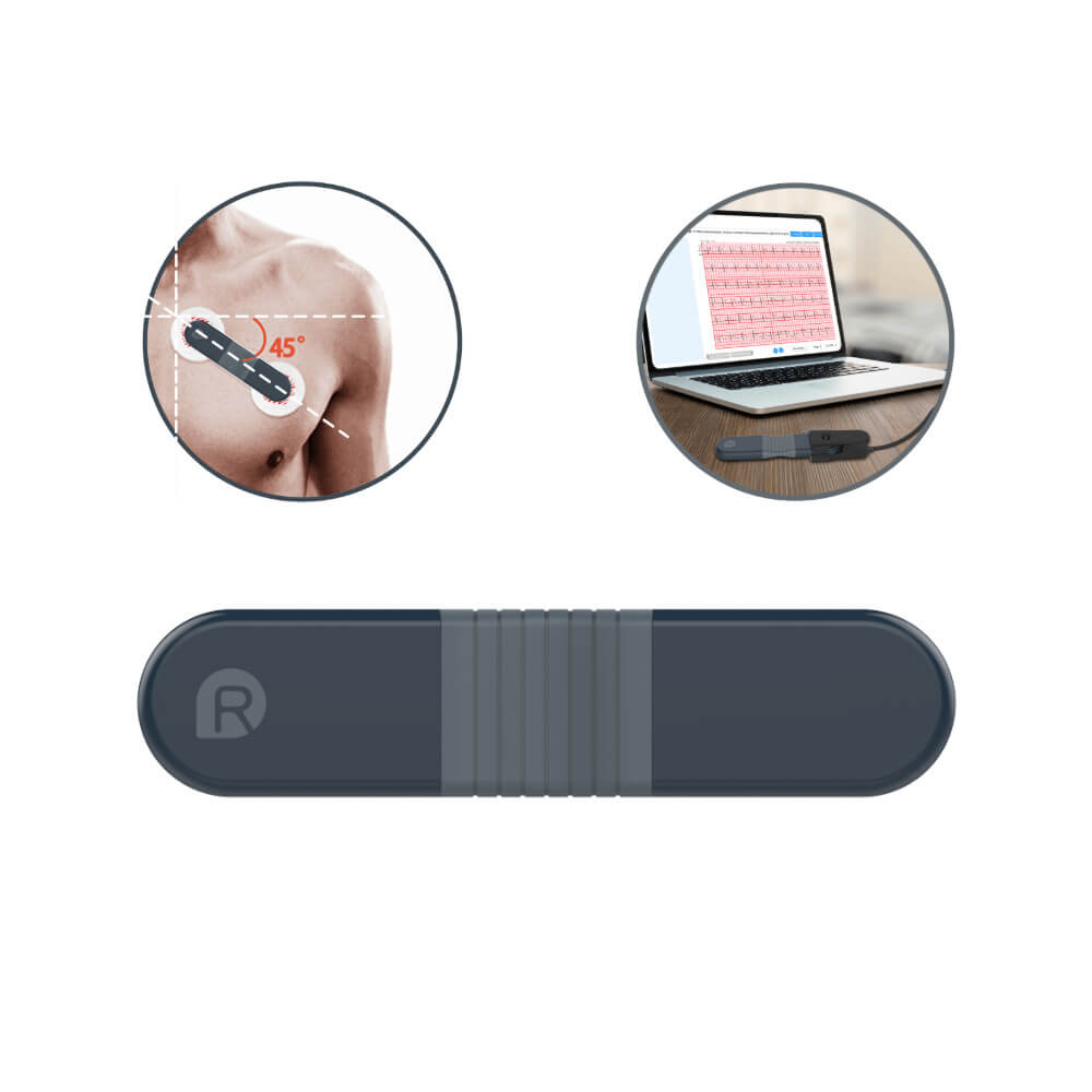 Disposable Electrode Patches for ECG Devices (60 Pcs)