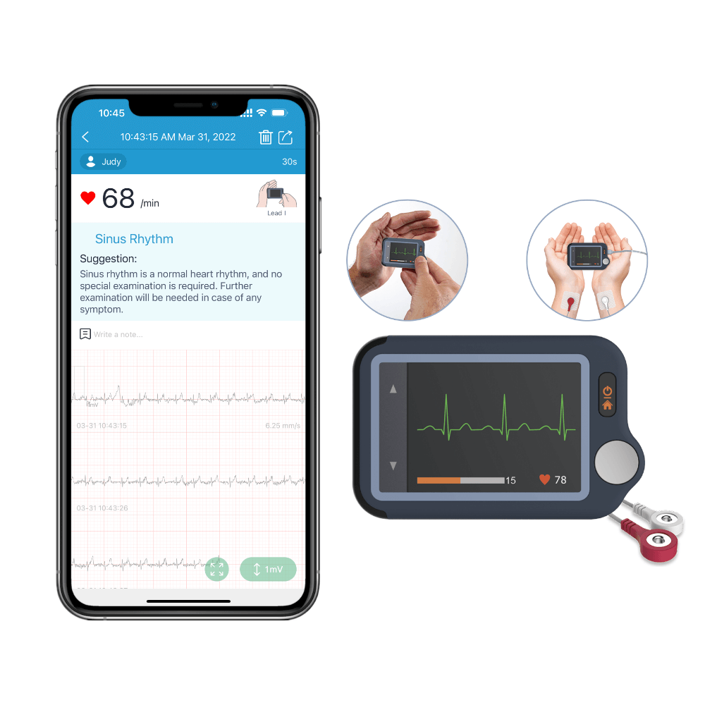 Wellue Blood Pressure Monitors with AI EKG Analysis,2 in 1 Upper Arm BP  Machine Cuff Kit and ECG Monitor for Home Wellness Use,BP2 Connect 