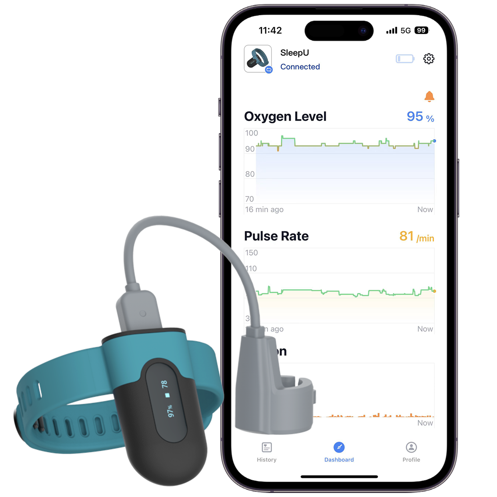 Wellue O2Ring Oxygen Monitor. Continuously Track Overnight Oxygen ...