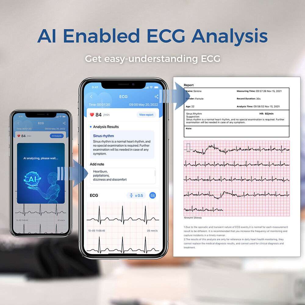 ecg reports
