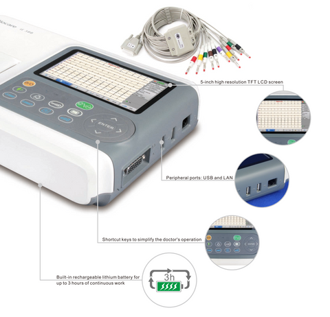 specific highlights of 12-lead ECG machine