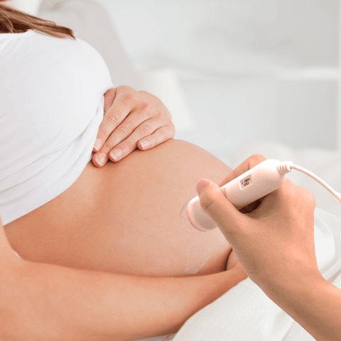 Babytone Fetal Heart Tracker (gel de acoplamiento incluido)