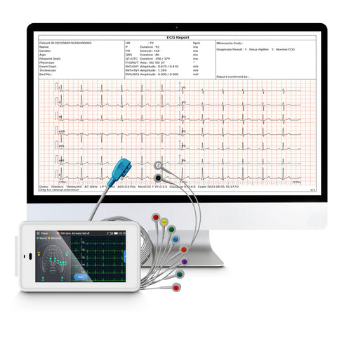 12-Kanal-EKG-Taschengerät und EKG-Bericht auf dem Desktop