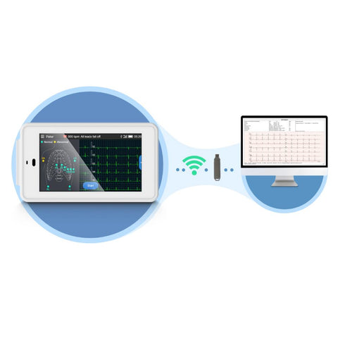 wirelessly transfer the ecg data to the computers or android devices via the USB disk or wifi network